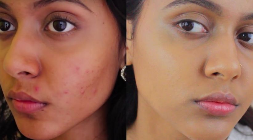 Before &After